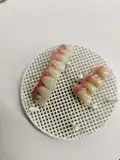 Restorative Dentistry zirconia